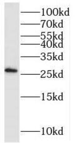PAIP2 Antibody - BSA Free, Novus Biologicals 100 &mu;g | Buy Online | Novus Biologicals | Fisher Scientific