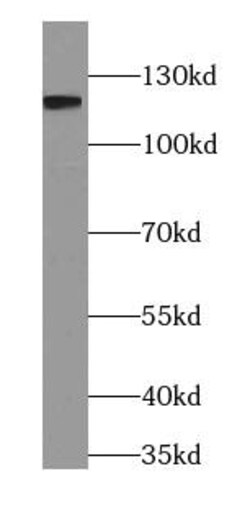 PACS2 Antibody - BSA Free, Novus Biologicals 100 &mu;g | Buy Online | Novus Biologicals | Fisher Scientific