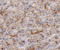 PACS2 Antibody - BSA Free, Novus Biologicals 100 &mu;g | Buy Online | Novus Biologicals | Fisher Scientific