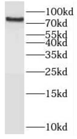 OSBPL10 Antibody - BSA Free, Novus Biologicals 100 &mu;g | Buy Online | Novus Biologicals | Fisher Scientific