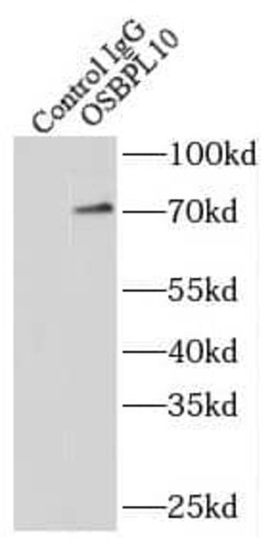 OSBPL10 Antibody - BSA Free, Novus Biologicals 100 &mu;g | Buy Online | Novus Biologicals | Fisher Scientific