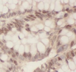 OSBPL10 Antibody - BSA Free, Novus Biologicals 100 &mu;g | Buy Online | Novus Biologicals | Fisher Scientific