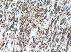 OPHN1 Antibody - BSA Free, Novus Biologicals 100 &mu;g | Buy Online | Novus Biologicals | Fisher Scientific