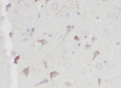 OGDHL Antibody - BSA Free, Novus Biologicals 100 &mu;g | Buy Online | Novus Biologicals | Fisher Scientific