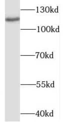 OGDHL Antibody - BSA Free, Novus Biologicals 100 &mu;g | Buy Online | Novus Biologicals | Fisher Scientific