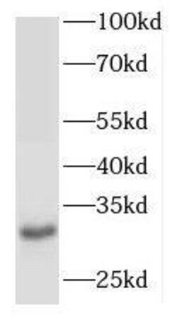 ODF3 Antibody - BSA Free, Novus Biologicals 100 &mu;g | Buy Online | Novus Biologicals | Fisher Scientific
