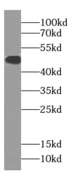 SLC22A16 Antibody - BSA Free, Novus Biologicals 100 &mu;g | Buy Online | Novus Biologicals | Fisher Scientific
