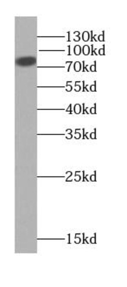 NWD1 Antibody - BSA Free, Novus Biologicals 100 &mu;g | Buy Online | Novus Biologicals | Fisher Scientific