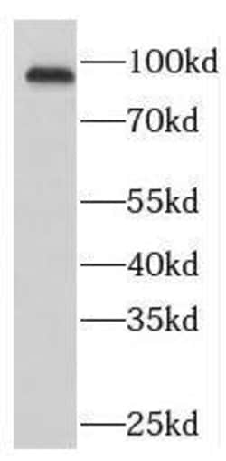 NUP93 Antibody - BSA Free, Novus Biologicals 100 &mu;g | Buy Online | Novus Biologicals | Fisher Scientific