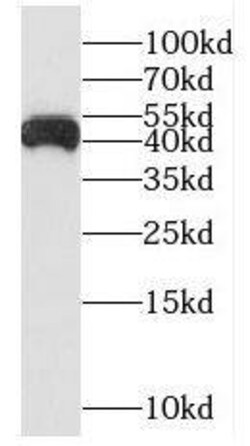 NUDT19 Antibody - BSA Free, Novus Biologicals 100 &mu;g | Buy Online | Novus Biologicals | Fisher Scientific