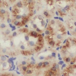 NUDT19 Antibody - BSA Free, Novus Biologicals 100 &mu;g | Buy Online | Novus Biologicals | Fisher Scientific