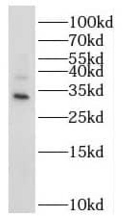 NT5C3L Antibody - BSA Free, Novus Biologicals 100 &mu;g | Buy Online | Novus Biologicals | Fisher Scientific