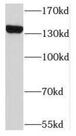 Nardilysin Antibody - BSA Free, Novus Biologicals 100 &mu;g | Buy Online | Novus Biologicals | Fisher Scientific