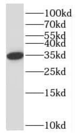 NPL Antibody - BSA Free, Novus Biologicals 100 &mu;g | Buy Online | Novus Biologicals | Fisher Scientific