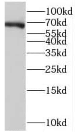NPAS1 Antibody - BSA Free, Novus Biologicals 100 &mu;g | Buy Online | Novus Biologicals | Fisher Scientific