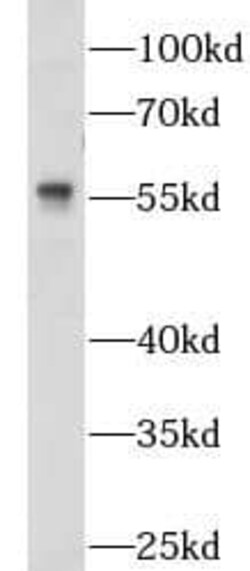 NOSTRIN Antibody - BSA Free, Novus Biologicals 100 &mu;g | Buy Online | Novus Biologicals | Fisher Scientific