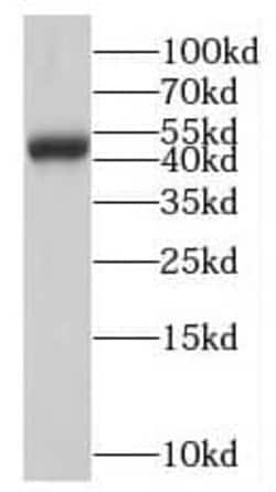 Neuromedin UR1/NMUR1 Antibody - BSA Free, Novus Biologicals 100 &mu;g | Buy Online | Novus Biologicals | Fisher Scientific