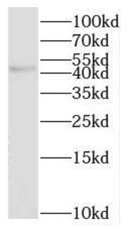 NHLRC1 Antibody - BSA Free, Novus Biologicals 100 &mu;g | Buy Online | Novus Biologicals | Fisher Scientific