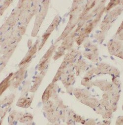 NHLRC1 Antibody - BSA Free, Novus Biologicals 100 &mu;g | Buy Online | Novus Biologicals | Fisher Scientific