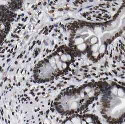 NGX6 Antibody - BSA Free, Novus Biologicals 100 &mu;g | Buy Online | Novus Biologicals | Fisher Scientific