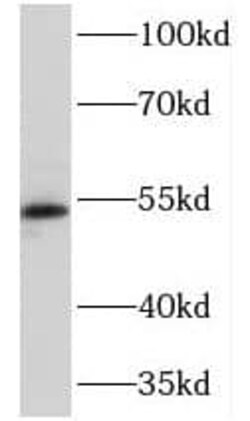 NEU4 Antibody - BSA Free, Novus Biologicals 100 &mu;g | Buy Online | Novus Biologicals | Fisher Scientific