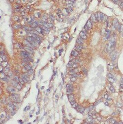 NET1 Antibody - BSA Free, Novus Biologicals 100 &mu;g | Buy Online | Novus Biologicals | Fisher Scientific