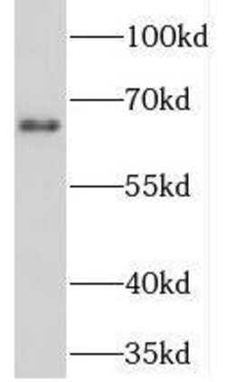 NET1 Antibody - BSA Free, Novus Biologicals 100 &mu;g | Buy Online | Novus Biologicals | Fisher Scientific