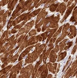 NDUFC1 Antibody - BSA Free, Novus Biologicals 100 &mu;g | Buy Online | Novus Biologicals | Fisher Scientific