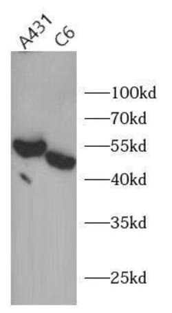 Suppressor of Fused Antibody - BSA Free, Novus Biologicals 100 &mu;g | Buy Online | Novus Biologicals | Fisher Scientific