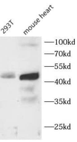 Complement Factor H-related 3/CFHR3 Antibody - BSA Free, Novus Biologicals 100 &mu;g | Buy Online | Novus Biologicals | Fisher Scientific
