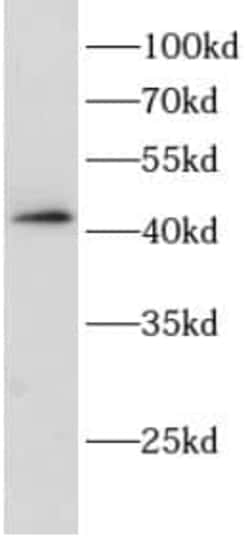 MAGEB18 Antibody - BSA Free, Novus Biologicals 100 &mu;g | Buy Online | Novus Biologicals | Fisher Scientific