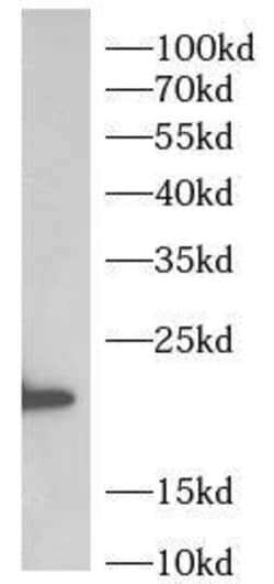 UCK2 Antibody - BSA Free, Novus Biologicals 100 &mu;g | Buy Online | Novus Biologicals | Fisher Scientific