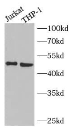 NEU3 Antibody - BSA Free, Novus Biologicals 100 &mu;g | Buy Online | Novus Biologicals | Fisher Scientific