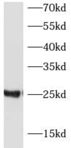 beta Casein Antibody - BSA Free, Novus Biologicals 100 &mu;g | Buy Online | Novus Biologicals | Fisher Scientific