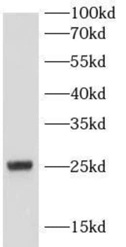 MT-ATP6 Antibody - BSA Free, Novus Biologicals 100 &mu;g | Buy Online | Novus Biologicals | Fisher Scientific