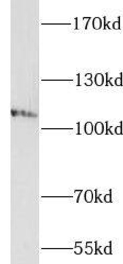 IQSEC1 Antibody - BSA Free, Novus Biologicals 100 &mu;g | Buy Online | Novus Biologicals | Fisher Scientific