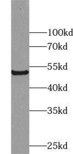 ZNF446 Antibody - BSA Free, Novus Biologicals 100 &mu;g | Buy Online | Novus Biologicals | Fisher Scientific