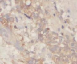 SLC30A7 Antibody - BSA Free, Novus Biologicals 100 &mu;g | Buy Online | Novus Biologicals | Fisher Scientific