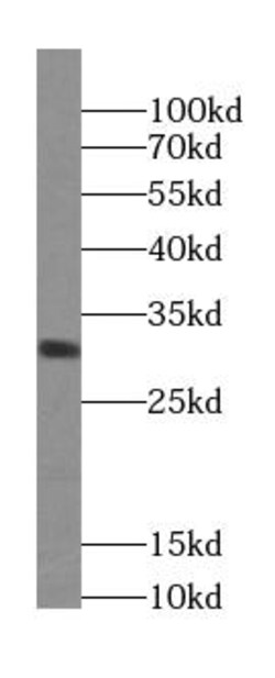 ZNRF2 Antibody - BSA Free, Novus Biologicals 100 &mu;g | Buy Online | Novus Biologicals | Fisher Scientific