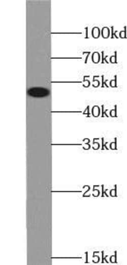 ZNHIT2 Antibody - BSA Free, Novus Biologicals 100 &mu;g | Buy Online | Novus Biologicals | Fisher Scientific