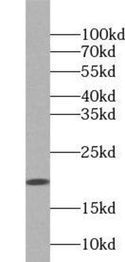 ZNHIT1 Antibody - BSA Free, Novus Biologicals 100 &mu;g | Buy Online | Novus Biologicals | Fisher Scientific