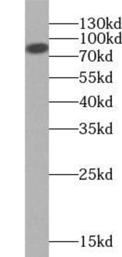NY-REN-50 antigen Antibody - BSA Free, Novus Biologicals 100 &mu;g | Buy Online | Novus Biologicals | Fisher Scientific