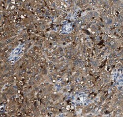 Coronin 3 Antibody - BSA Free, Novus Biologicals 100 &mu;g | Buy Online | Novus Biologicals | Fisher Scientific