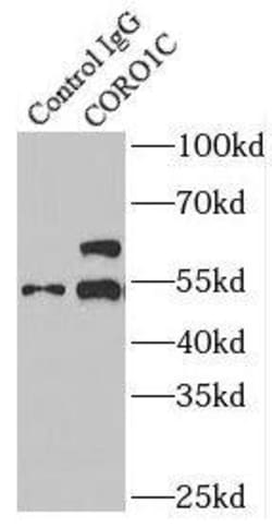 Coronin 3 Antibody - BSA Free, Novus Biologicals 100 &mu;g | Buy Online | Novus Biologicals | Fisher Scientific