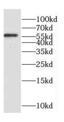Coronin 3 Antibody - BSA Free, Novus Biologicals 100 &mu;g | Buy Online | Novus Biologicals | Fisher Scientific