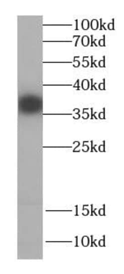CPOX Antibody - BSA Free, Novus Biologicals 100 &mu;g | Buy Online | Novus Biologicals | Fisher Scientific