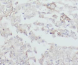 CPOX Antibody - BSA Free, Novus Biologicals 100 &mu;g | Buy Online | Novus Biologicals | Fisher Scientific