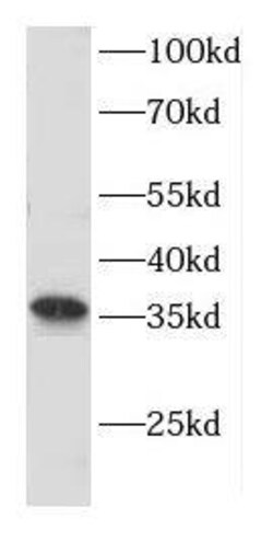 CNTD Antibody - BSA Free, Novus Biologicals 100 &mu;g | Buy Online | Novus Biologicals | Fisher Scientific