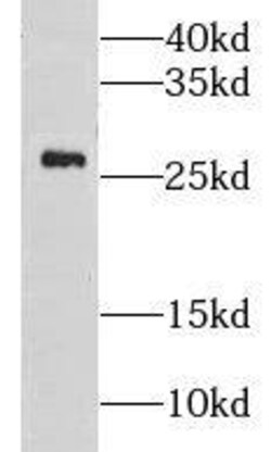 CMBL Antibody - BSA Free, Novus Biologicals 100 &mu;g | Buy Online | Novus Biologicals | Fisher Scientific