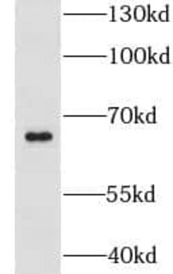 CLIP4 Antibody - BSA Free, Novus Biologicals 100 &mu;g | Buy Online | Novus Biologicals | Fisher Scientific